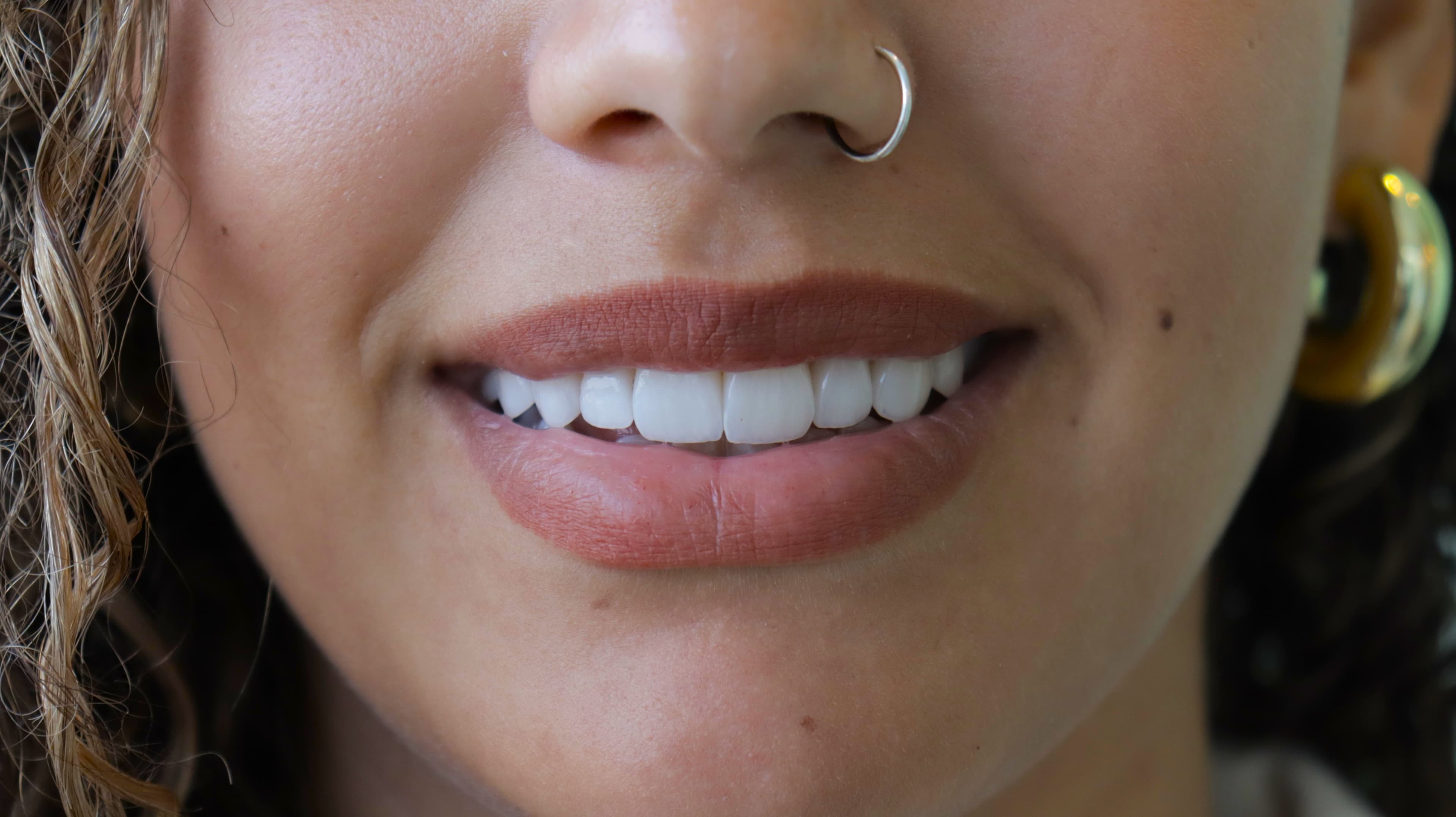 After Natural Ceramic Lenses