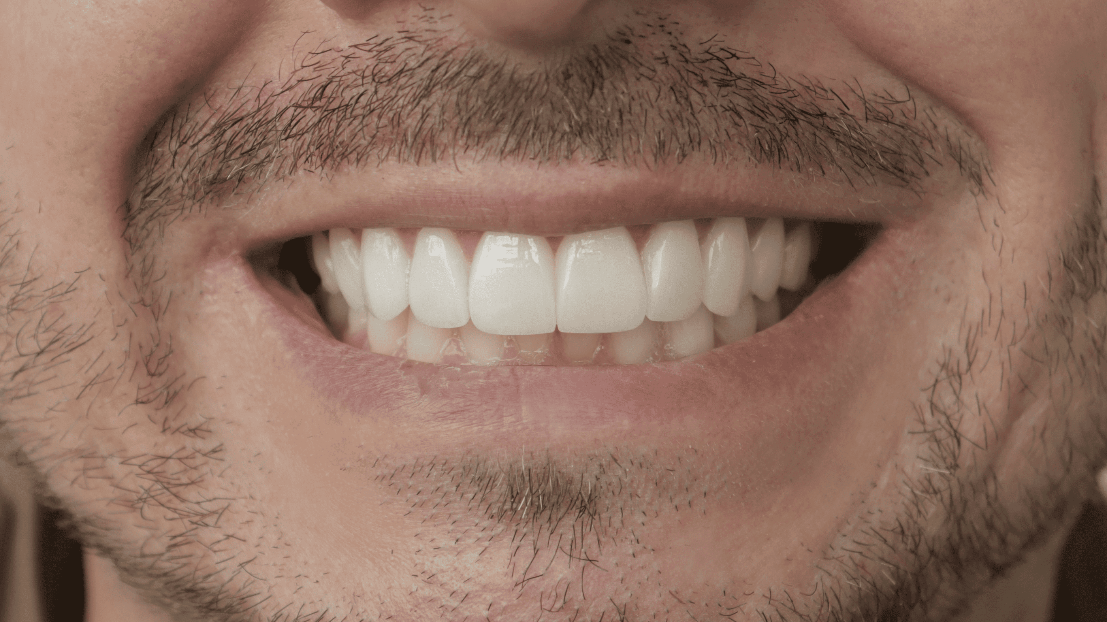 After Natural Ceramic Lenses