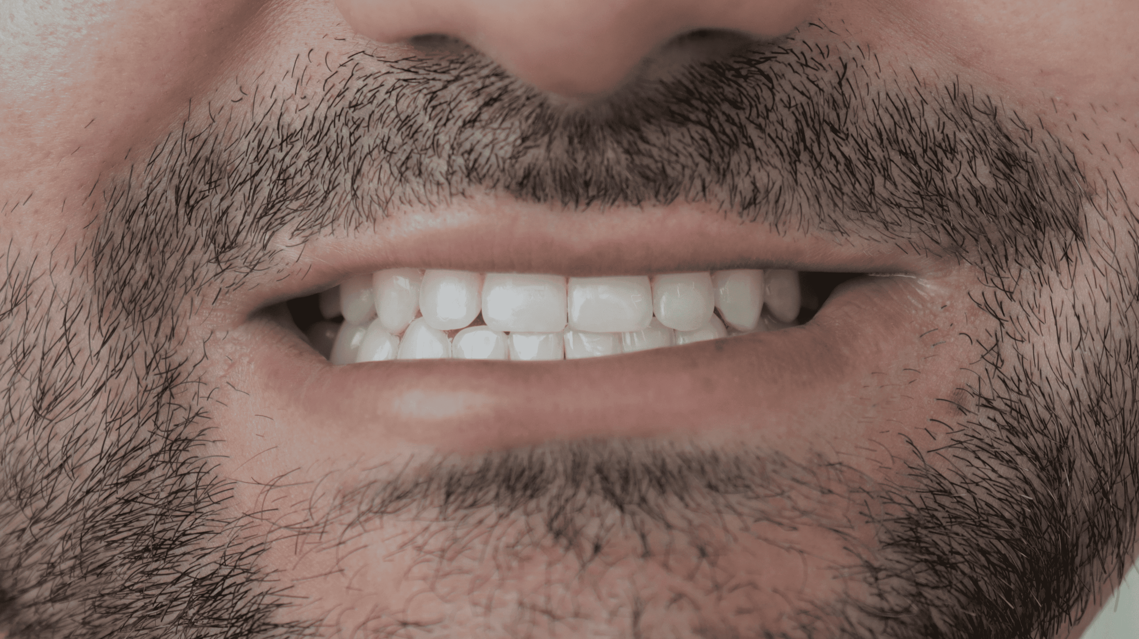 Before Natural ceramic lenses