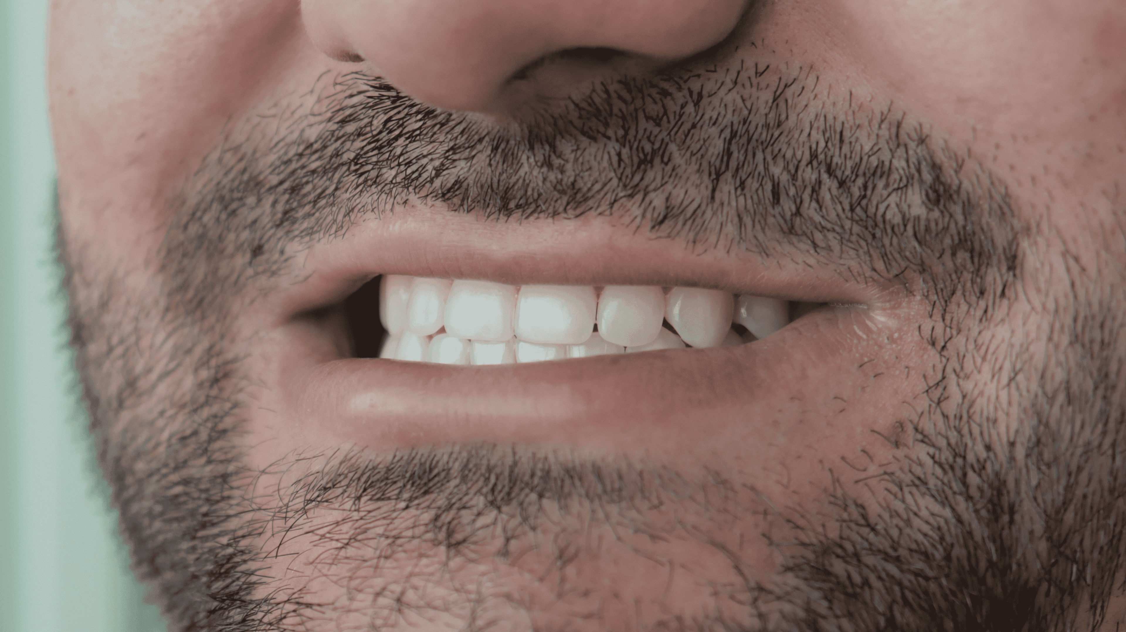 Before Natural ceramic lenses