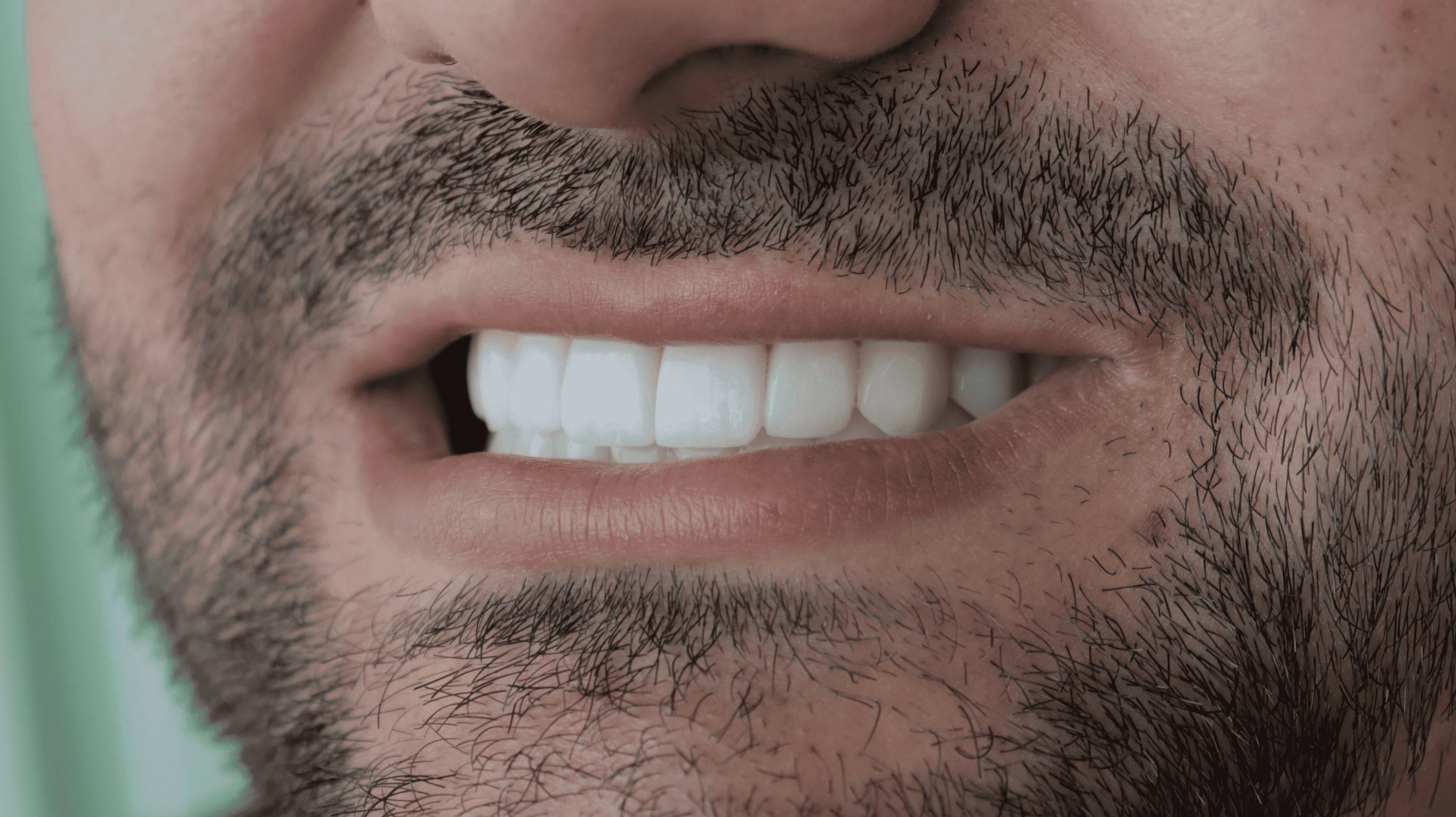 After Natural ceramic lenses