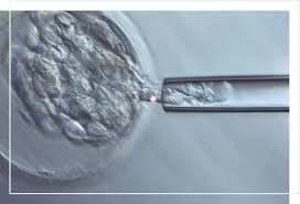 DGP diagnostico