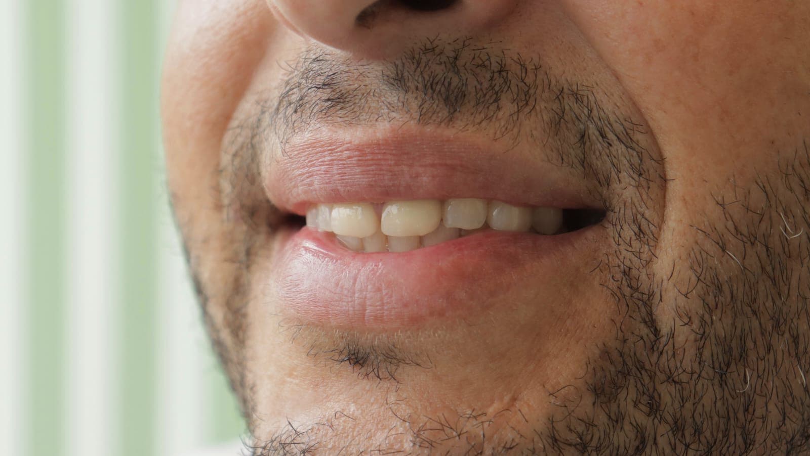 Before Natural Ceramic Lenses