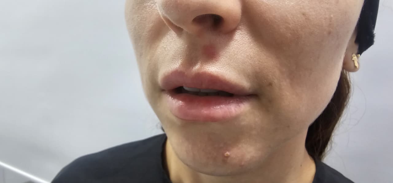 Before Lips