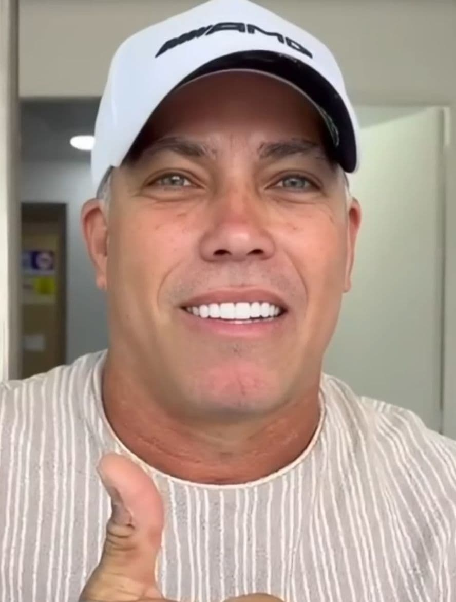 After After orthodontics with aligners, CERAMIC LENSES are performed.