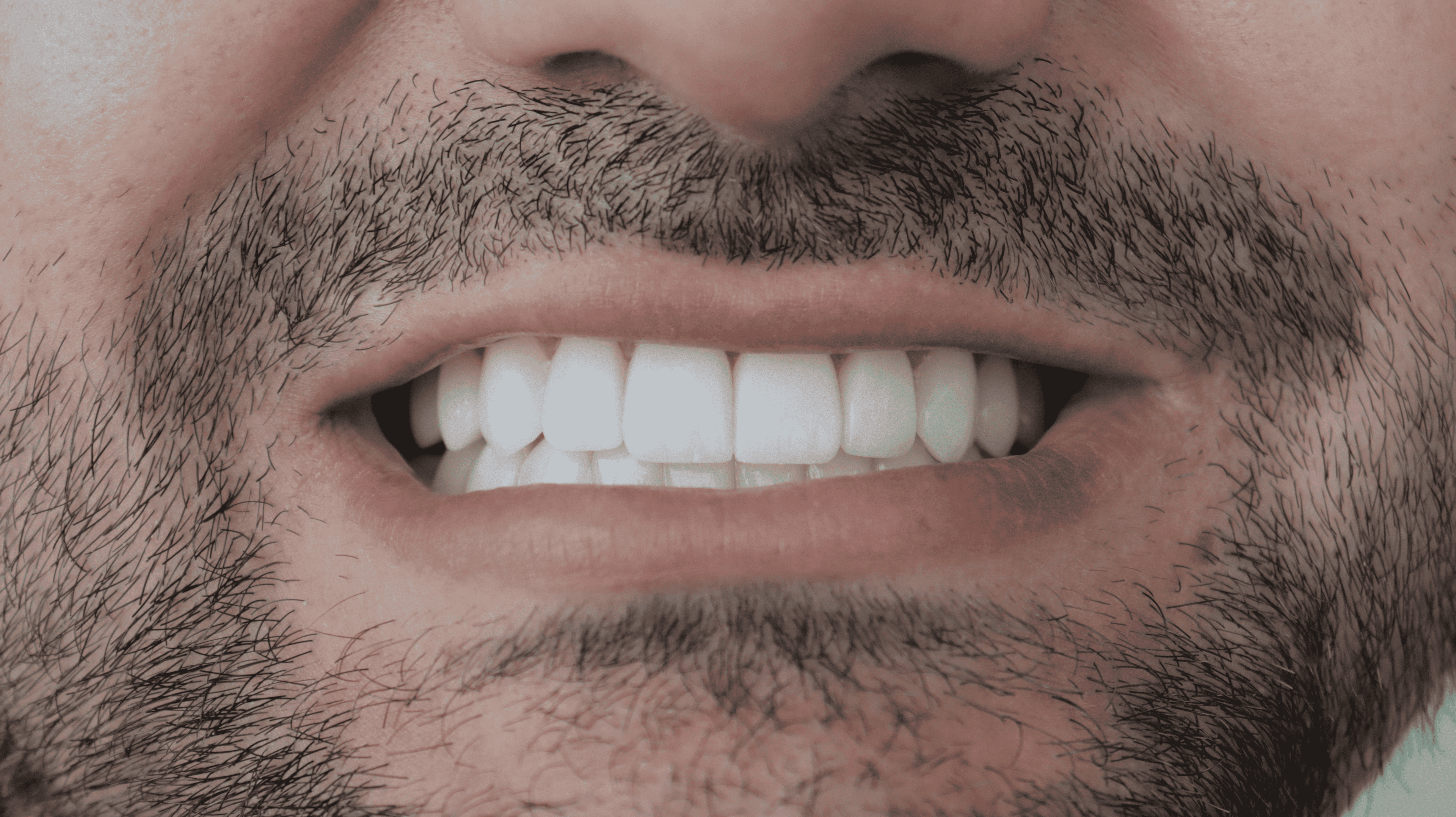 After Natural ceramic lenses